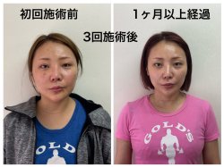 お顔の歪みが気になる方