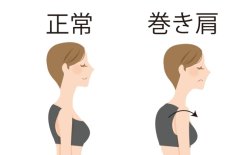 巻き肩でお悩みの方
