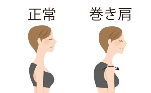 巻き肩でお悩みの方