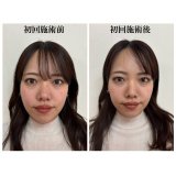 ホットペッパービューティーにてお得なクーポンあります