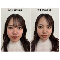 ホットペッパービューティーにてお得なクーポンあります