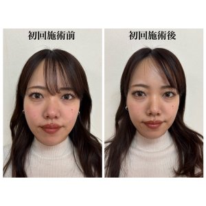 ホットペッパービューティーにてお得なクーポンあります