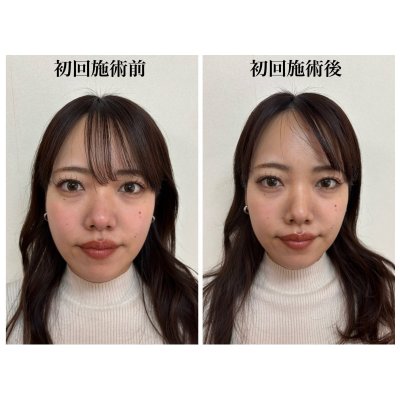 画像1: ホットペッパービューティーにてお得なクーポンあります