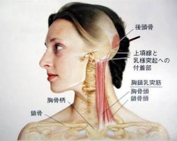 胸鎖乳突筋が張る理由